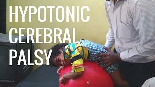 Hypotonic Cerebral Palsy Home Tips amp Physiotherapy [upl. by Healy]