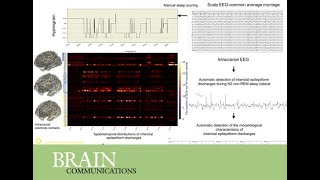 IEDs show distinct spatiotemporal and morphological patterns across wake and sleep [upl. by Ancelin]