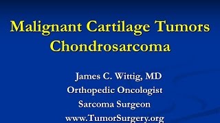 Orthopedic Oncology Course  Malignant Cartilage Tumors Chondrosarcoma  Lecture 6 [upl. by Stout944]