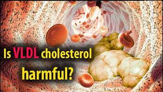 Is VLDL cholesterol harmful  Natural Health [upl. by Langley]