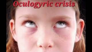 Oculogyric crisis mrcpch Communication [upl. by Angelika]