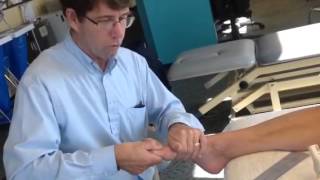 Hallux Limitus Evaluation with Self Mobilization [upl. by Meara349]