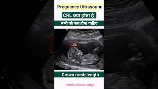 Pregnancy report में CRL क्या होता है  Pregnancy ultrasound report देखना सीखे pregnancy [upl. by Ahsinauj]