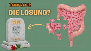 Den Darm entfernen lassen  Die Lösung bei Colitis Ulcerosa  Morbus Crohn Meine Meinung [upl. by Felty]