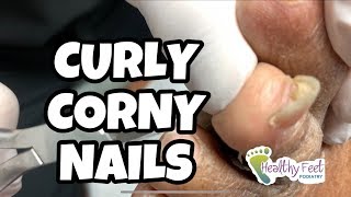 Cutting Curly Corny Nails [upl. by Lasky]