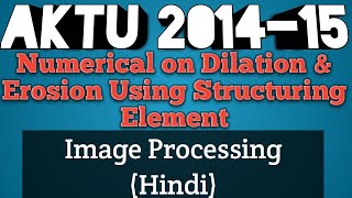 AKTU 2014 15 Numerical On Dilation And Erosion  Image Processing AKTU  Dilation and Erosion [upl. by Elsy408]