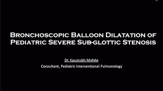 Bronchoscopic Balloon Dilatation in Post intubation Severe Subglottic Stenosis in childhood [upl. by Fawcett828]