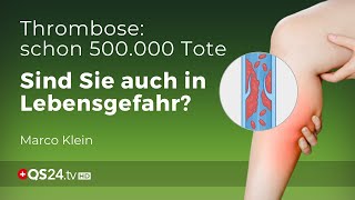 Thrombose – Prophylaxe und Behandlung  Kleinsche Felder  Marco Klein  QS24 Gesundheitsfernsehen [upl. by Rigdon69]