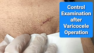 First Control Examination on the 4th day after Varicocele Operation [upl. by Kaazi]