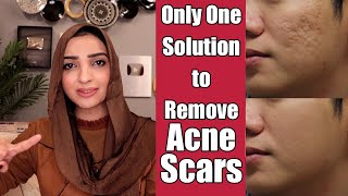 REMOVE FACE SCARS ACNE SPOTS amp PIMPLES MEDICATED GEL REVIEW [upl. by Ehcnalb]