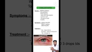 Conjuctivitis treatment [upl. by Aronow]