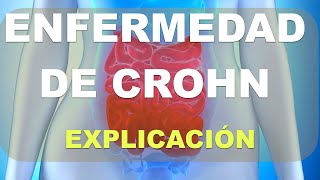 Qué es la Enfermedad de CROHN [upl. by Ayanej]