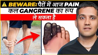 Claudication Gangrene Problems And Solutions  Dr Gaurav Gangwani Interventional Radiologist [upl. by Ayik747]