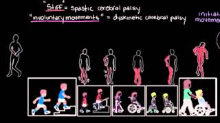 Khan Academy  Types of Cerebral Palsy Part 2 Dyskinetic amp Ataxic [upl. by Donnell]