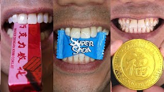 Daily Viral Candy and Chocolate Chewing Sounds Doctor Tristan Peh ASMR [upl. by Ramo442]