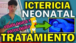 ICTERICIA NEONATAL TRATAMIENTO  GuiaMed [upl. by Pentheam]