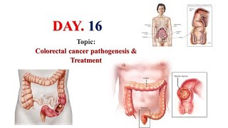 oncology course day 16  ColorectalCancer  treatment  folfox regimen PharmD [upl. by Pietje]