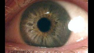 Eye Works 1 Focusing Cornea Iris and Lens [upl. by Nirag]