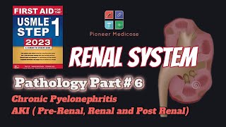 Acute Kidney Injury and Chronic Pyelonephritis for USMLE step 1pathology Part 6UrduHindi [upl. by Eylrahc270]