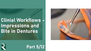 Transition Toward Digital Dentures Clinical Workflows  Impressions and Bite in Dentures 512 [upl. by Schou]