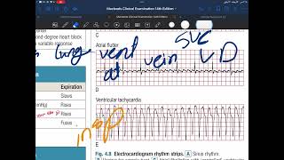 Physical examination of cardiovascular system 2 [upl. by Mitinger]