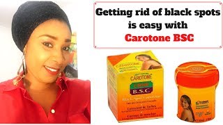 Carotone black spot Corrector review Fade off black spots quickly [upl. by Matty]