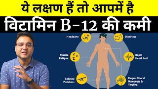 Vitamin B12 Deficiency Symptoms You Must Not Ignore B12 की कमी होने से दिखाई देते हैं ये लक्षण [upl. by Ayokal]