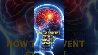 HOW TO PREVENT STROKE OR PARALYTIC ATTACK stroke paralysisdiabetesdrvijaychile [upl. by Eak10]