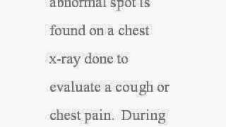 Diagnosis of Lung Cancer  Lung Cancer Diagnosis [upl. by Octave1]