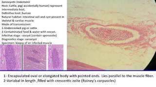 28 Practical Parasitology  Sarcocystis lindemanii  Sarcocyst Stage [upl. by Selda]