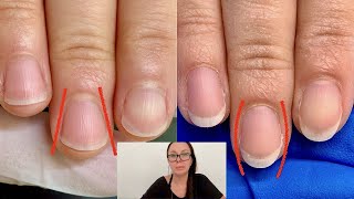 How I shaped these nails from fanning out to oval Nail technician explains [upl. by Eada]