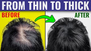 The Ultimate Guide to Thicker Hair – Dr Bergs Expert Advice [upl. by Atsylak]