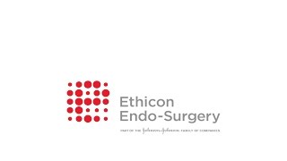 „The science of tissue managment“  Ethicon EndoSurgery [upl. by Arlee]