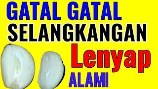 WOWGatal Gatal SELANGKANGAN Sembuh Dengan Tanpa Biaya MAHAL [upl. by Gerik879]