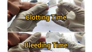 bt ct blood test bt ct Bleeding Time amp Clotting Time Test  Capillary tube method [upl. by Hobie]