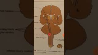 Descending tracts Rubrospinal tractolivospinal tractreticulospinal tractvestibulospinal Tract [upl. by Anehsat]