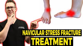 Navicular Stress Fracture Treatment Exercise Shoes amp Stretches [upl. by Ayahsal366]