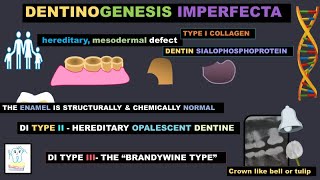 Dentinogenesis Imperfecta [upl. by Lamdin789]