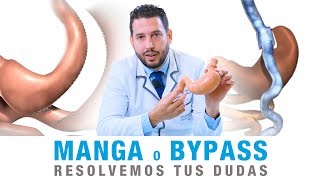 Diferencias entre Bypass Gástrico y Manga Gástrica  Clínicas Diego de León [upl. by Means]