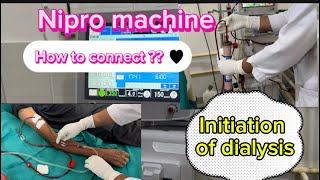 Initiation of hemodialysis via AV fistula nipro machine hemodialysishospital ckdpatient [upl. by Burr465]