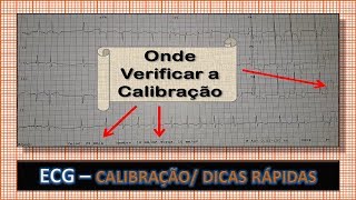 ECG  Onde Analisar a Calibração no Eletrocardiograma 📌 Dicas Rápidas [upl. by Ayotak931]