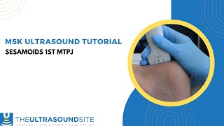 MSK ultrasound evaluation of the Sesamoid bones of the big toe of the foot [upl. by Mada]