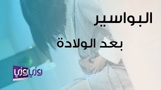 البواسير بعد الولادة [upl. by Nyloj]