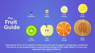 Cervical Dilatation [upl. by Shipley]