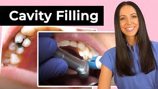 Dentist Filling a Cavity Between Teeth [upl. by Atinahs]