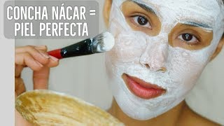 Elimina Cicatrices De Acne Estrias y Aclarar La Piel Con Concha Nacar En 1 Semana [upl. by Asenev]