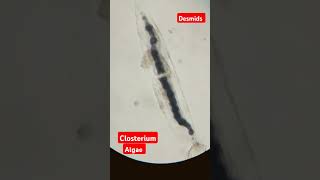 Closterium algae view under microsporeDesmidsMsc Botanypractical mscbotany botany shorts [upl. by Atilem]