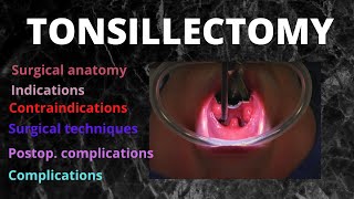 066 Tonsillectomy tonsillitis [upl. by Linn]