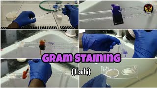 Gram Staining  Demo  Smear Preparation  Microbiology Lab  Tamil  Biology  ThiNK VISION  TNK [upl. by Erb]