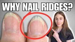 Why You Have Vertical Nail Ridges And How To Get Rid Of Them [upl. by Aninaj]